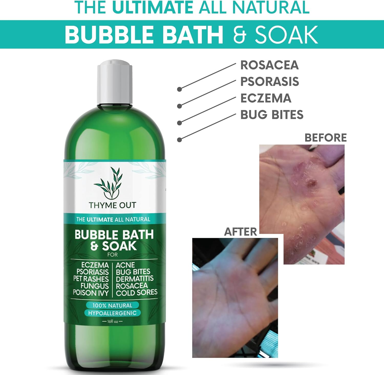 Thyme Out All-Natural Bubble Bath - Hypoallergenic Skin-Soothing Thyme Bath Foam - Sulfate-Free, Paraben-Free Formula Provides Deep Moisturization and Hydration for All Skin Types - 16 Oz